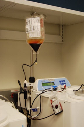 Cord Blood Unit Seperation